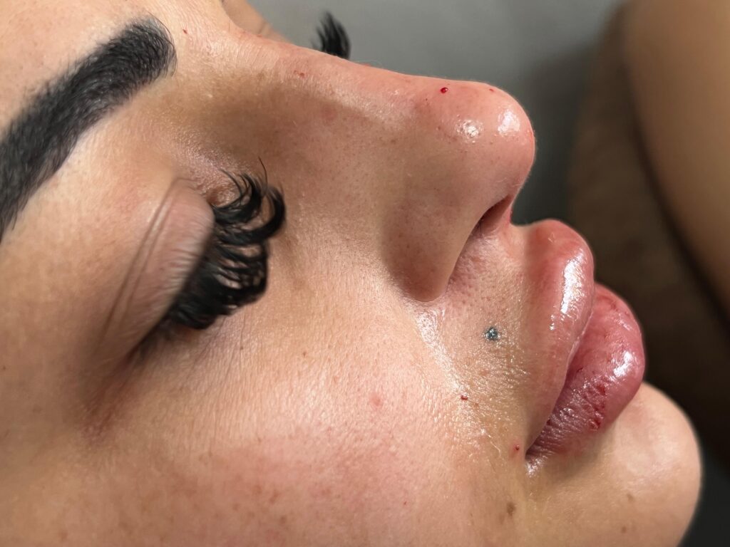 Cilt Bakımı Botox Dolgu ve Mezoterapi Çözümleri